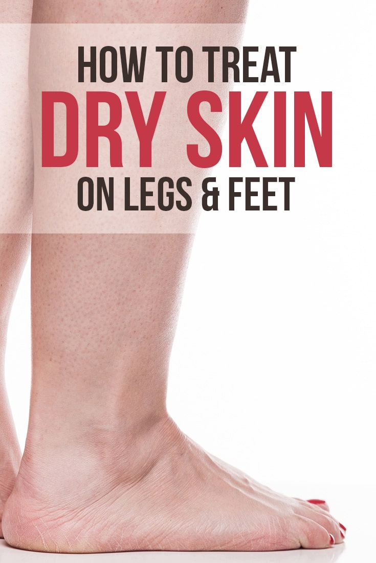 What Causes & How to Treat Dry Skin  approaching Legs : Skin Care Tips