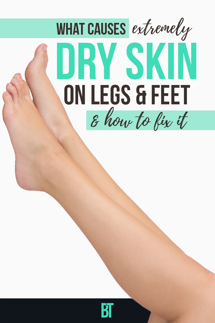 What Causes & How to Treat Dry Skin  on the order of Legs : Skin Care Tips