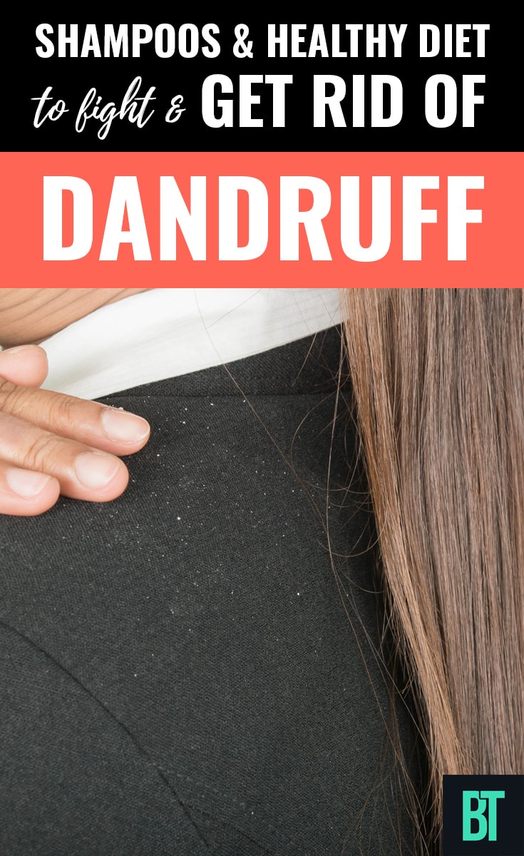 Shampoos & healthy diet to fight dandruff
