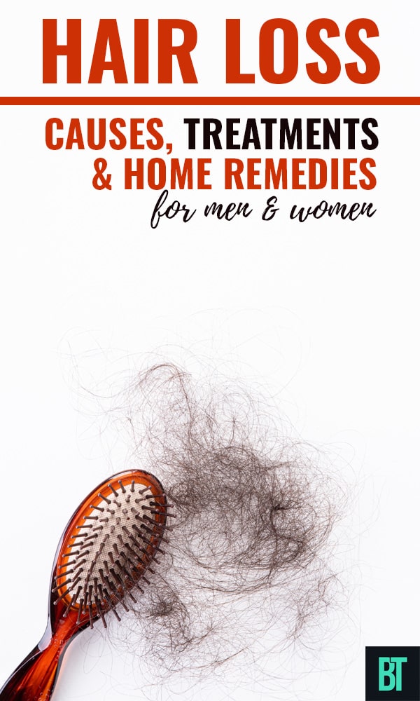 Hair loss causes, treatments & home remedies for men and women.