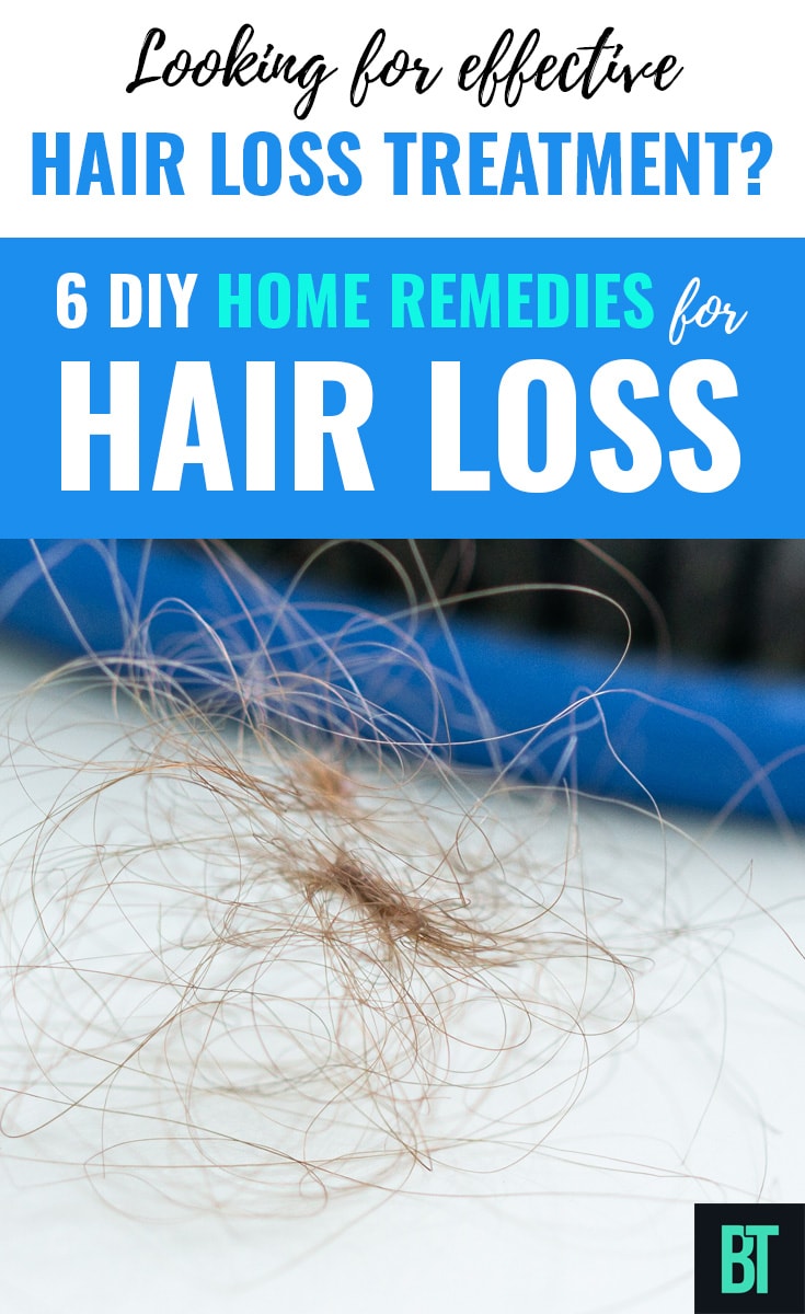 DIY Hair Loss Treatments