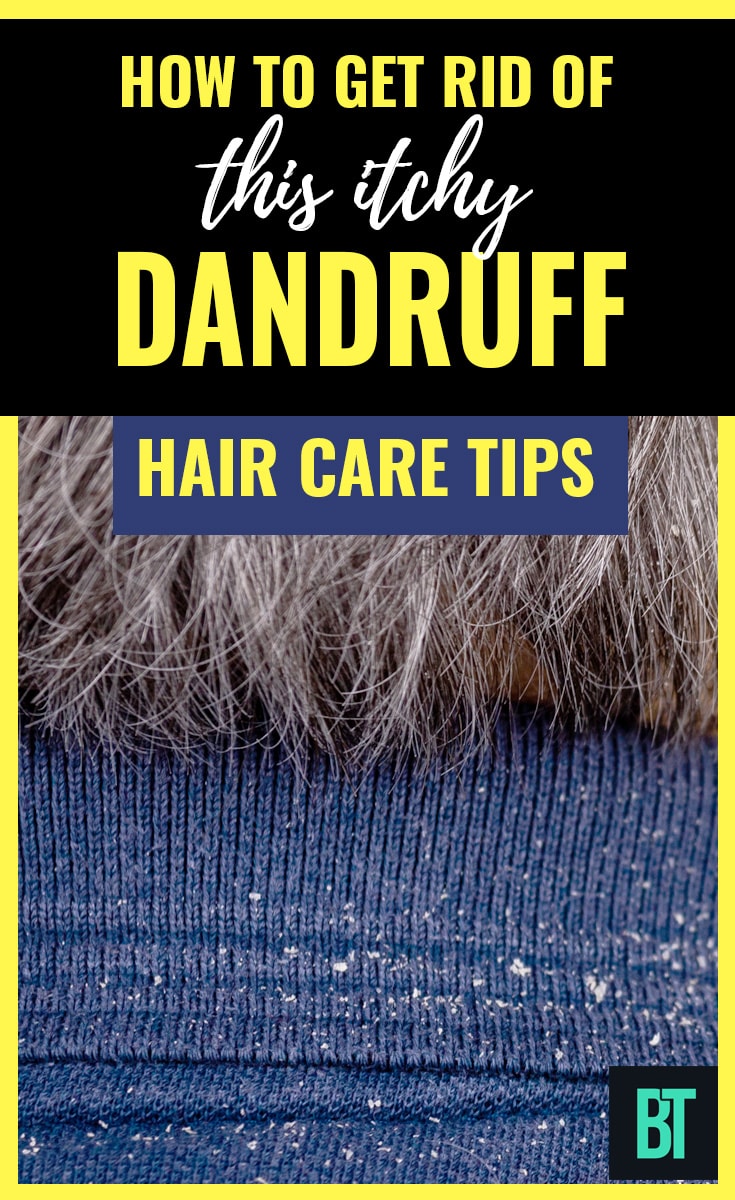 How to Get Rid of Dandruff: Hair Care Tips