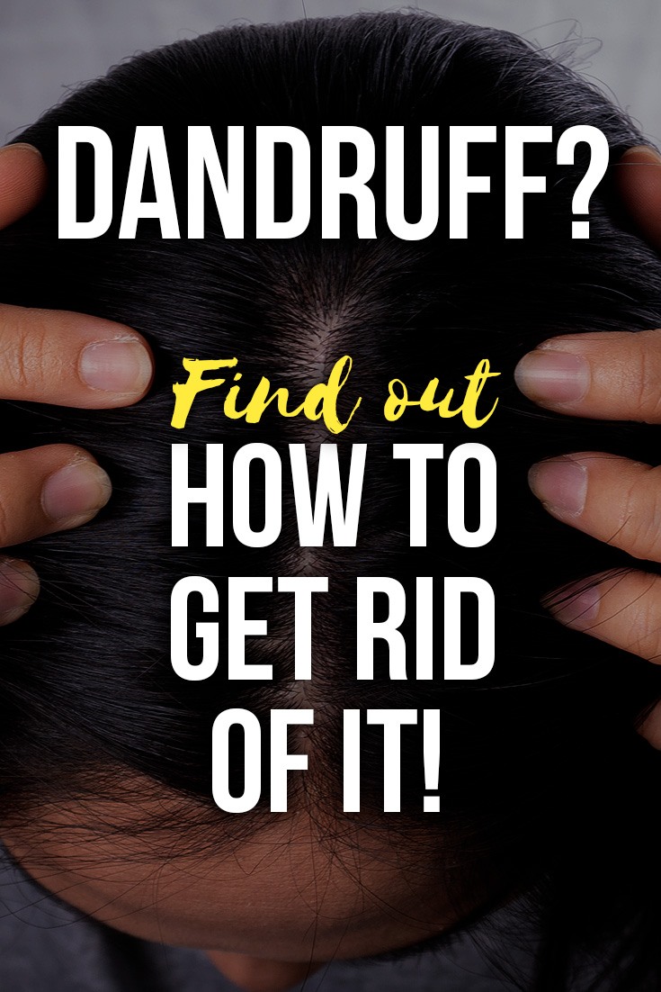 How to Get Rid of Dandruff