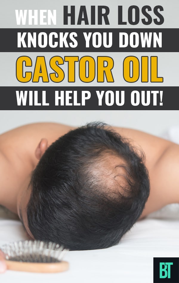 How Castor Oil Can Help with Hair Loss for men and women.