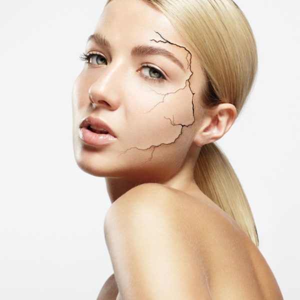 Dry, Cracked Skin on a Woman
